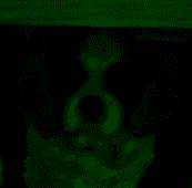 Om0HxYyjWt.png