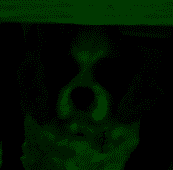 xMz7P7AUco.png